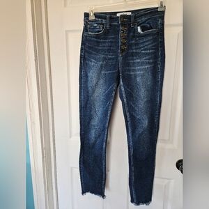 High-Rise Button-Fly Dark Blue Women’s Jeans